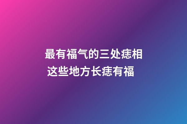 最有福气的三处痣相 这些地方长痣有福